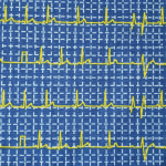 Blue grid with yellow pulse lines swatch